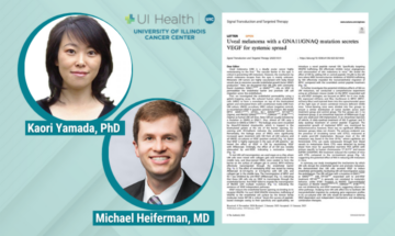 Discover the ocular cancer publication from UIC Today featuring research on uveal melanoma by Kaori Yamada, PhD, and Michael Heiferman, MD.