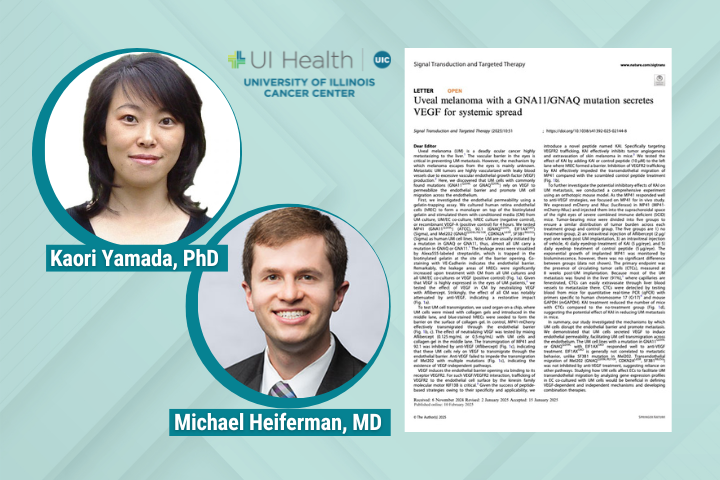 Discover the ocular cancer publication from UIC Today featuring research on uveal melanoma by Kaori Yamada, PhD, and Michael Heiferman, MD.